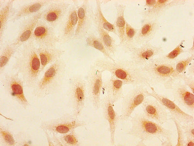 Immunocytochemistry analysis of Hela cells using Mono-methyl-HIST1H3A (K9) Antibody at dilution of 1:100Rabbit anti-Human HIST1H3A Polyclonal Antibody