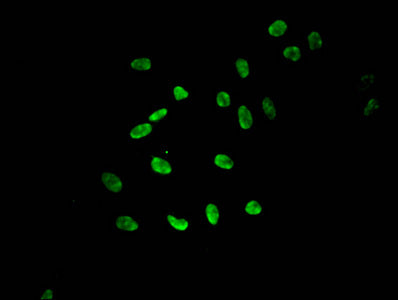 Immunofluorescent analysis of Hela cells using Mono-methyl-HIST1H3A (K9) Antibody at dilution of 1:100 and Alexa Fluor 488-congugated AffiniPure Goat Anti-Rabbit IgG(H+L)Rabbit anti-Human HIST1H3A Polyclonal Antibody