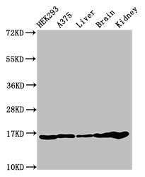 Western Blot  | Positive WB detected in: HEK293 cell acid extracts, A375 cell acid extracts, Mouse liver tissue, Mouse brain tissue, Mouse kidney tissue  | All lanes: HIST1H3A antibody at 1µg/ml  | Secondary  | Goat polyclonal to rabbit IgG at 1/50000 dilution  | Predicted band size: 16 kDa  | Observed band size: 16 kDaRabbit anti-Human HIST1H3A Polyclonal Antibody