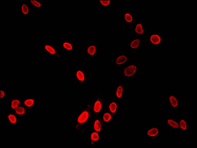 Immunofluorescent analysis of Hela cells using HIST1H3A (Ab-9) Antibody at dilution of 1:100 and Cy3-congugated Goat Anti-Rabbit IgGRabbit anti-Human HIST1H3A Polyclonal Antibody