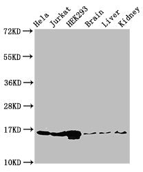 Western Blot  | Positive WB detected in: Hela cell acid extracts, Jurkat cell acid extracts, HEK293 cell acid extracts, Mouse brain tissue, Mouse liver tissue, Mouse kidney tissue  | All lanes: HIST1H3A antibody at 1µg/ml  | Secondary  | Goat polyclonal to rabbit IgG at 1/50000 dilution  | Predicted band size: 16 kDa  | Observed band size: 16 kDaRabbit anti-Human HIST1H3A Polyclonal Antibody
