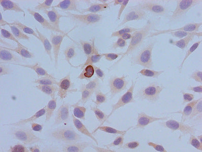 Immunocytochemistry analysis of Hela cells using Phospho-HIST1H3A (S10) Antibody at dilution of 1:100Rabbit anti-Human HIST1H3A Polyclonal Antibody