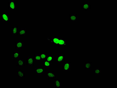 Immunofluorescent analysis of Hela cells using HIST1H3A (Ab-14) Antibody at dilution of 1:100 and Alexa Fluor 488-congugated AffiniPure Goat Anti-Rabbit IgG(H+L)Rabbit anti-Human HIST1H3A Polyclonal Antibody