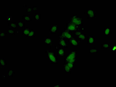 Immunofluorescent analysis of Hela cells using HIST1H3A (Ab-17) Antibody at dilution of 1:100 and Alexa Fluor 488-congugated AffiniPure Goat Anti-Rabbit IgG(H+L)Rabbit anti-Human HIST1H3A Polyclonal Antibody