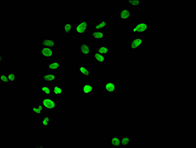 Immunofluorescent analysis of Hela cells using HIST1H3A (Ab-17) Antibody at dilution of 1:100 and Alexa Fluor 488-congugated AffiniPure Goat Anti-Rabbit IgG(H+L)Rabbit anti-Human HIST1H3A Polyclonal Antibody