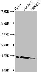 Western Blot  | Positive WB detected in: Hela cell acid extracts, Jurkat cell acid extracts, HEK293 cell acid extracts  | All lanes: HIST1H3A antibody at 2µg/ml  | Secondary  | Goat polyclonal to rabbit IgG at 1/50000 dilution  | Predicted band size: 16 kDa  | Observed band size: 16 kDaRabbit anti-Human HIST1H3A Polyclonal Antibody