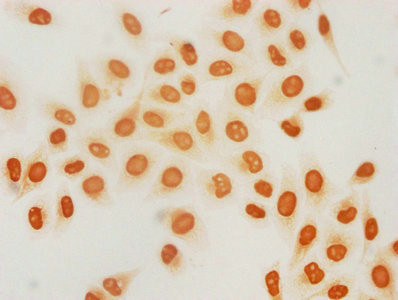 Immunocytochemistry analysis of 2-hydroxyisobutyryl-HIST1H3A (K18) Antibody diluted at 1:25 and staining in Hela cells (treated with 30mM sodium butyrate for 4h) performed on a Leica BondTM system. The cells were fixed in 4% formaldehyde, permeabilized using 0.2% Triton X-100 and blocked with 10% normal goat serum 30min at RT. Then primary antibody (1% BSA) was incubated at 4°C overnight. The primary is detected by a biotinylated secondary antibody and visualized using an HRP conjugated SP system.Rabbit anti-Human HIST1H3A Polyclonal Antibody