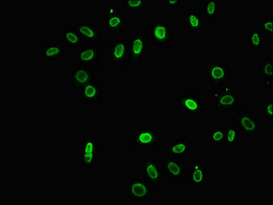 Immunofluorescence staining of Hela cells (treated with 30mM sodium butyrate for 4h) with 2-hydroxyisobutyryl-HIST1H3A (K18) Antibody at 1:12.5, counter-stained with DAPI. The cells were fixed in 4% formaldehyde, permeabilized using 0.2% Triton X-100 and blocked in 10% normal Goat Serum. The cells were then incubated with the antibody overnight at 4°C. The secondary antibody was Alexa Fluor 488-congugated AffiniPure Goat Anti-Rabbit IgG(H+L).Rabbit anti-Human HIST1H3A Polyclonal Antibody
