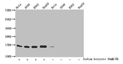 Western Blot  | Detected samples: Hela whole cell lysate, A549 whole cell lysate, K562 whole cell lysate, HepG2 whole cell lysate; Untreated (-) or treated (+) with 30mM sodium butyrate for 4h  | All lanes: HIST1H3A antibody at 1.1µg/ml  | Secondary  | Goat polyclonal to rabbit IgG at 1/50000 dilution  | Predicted band size: 16 kDa  | Observed band size: 16 kDaRabbit anti-Human HIST1H3A Polyclonal Antibody