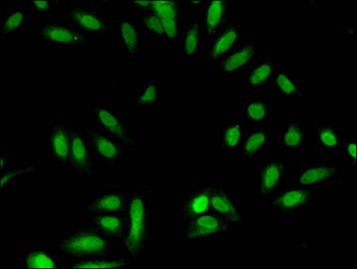 Immunofluorescent analysis of Hela cells using HIST1H3A (Ab-18) Antibody at dilution of 1:100 and Alexa Fluor 488-congugated AffiniPure Goat Anti-Rabbit IgG(H+L)Rabbit anti-Human HIST1H3A Polyclonal Antibody