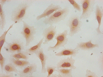 Immunocytochemistry analysis of Hela cells using Mono-methyl-HIST1H3A (K36) Antibody at dilution of 1:100Rabbit anti-Human HIST1H3A Polyclonal Antibody