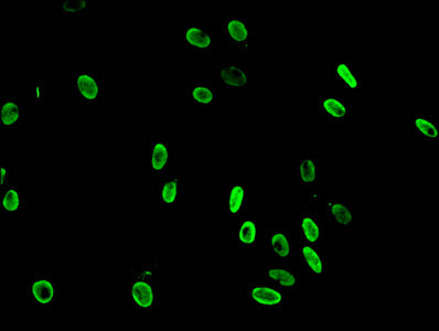 Immunofluorescent analysis of Hela cells using Mono-methyl-HIST1H3A (K36) Antibody at dilution of 1:100 and Alexa Fluor 488-congugated AffiniPure Goat Anti-Rabbit IgG(H+L)Rabbit anti-Human HIST1H3A Polyclonal Antibody