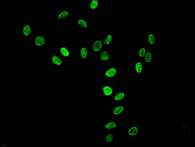 Immunofluorescent analysis of Hela cells using Tri-methyl-HIST1H3A (K36) Antibody at dilution of 1:100 and Alexa Fluor 488-congugated AffiniPure Goat Anti-Rabbit IgG(H+L)Rabbit anti-Human HIST1H3A Polyclonal Antibody