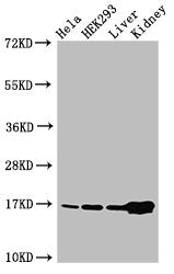 Western Blot  | Positive WB detected in: Hela cell acid extracts, HEK293 cell acid extracts, Mouse liver tissue, Mouse kidney tissue  | All lanes: HIST1H3A antibody at 2µg/ml  | Secondary  | Goat polyclonal to rabbit IgG at 1/50000 dilution  | Predicted band size: 16 kDa  | Observed band size: 16 kDaRabbit anti-Human HIST1H3A Polyclonal Antibody