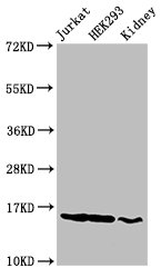 Western Blot  | Positive WB detected in: Jurkat cell acid extracts, HEK293 cell acid extracts, Rat kidney tissue  | All lanes: HIST1H3A antibody at 2µg/ml  | Secondary  | Goat polyclonal to rabbit IgG at 1/50000 dilution  | Predicted band size: 16 kDa  | Observed band size: 16 kDaRabbit anti-Human HIST1H3A Polyclonal Antibody