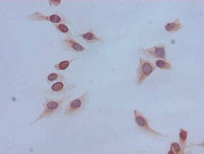 Immunocytochemistry analysis of Hela cells using Acetyl-HIST1H4A (K16) Antibody at dilution of 1:100Rabbit anti-Human HIST1H4A Polyclonal Antibody