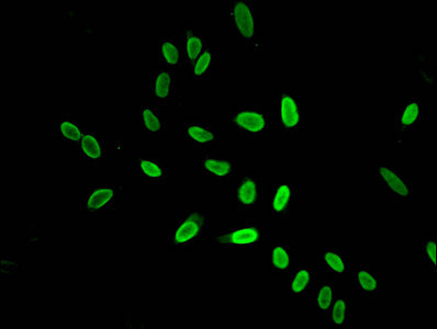 Immunofluorescent analysis of Hela cells using Acetyl-HIST1H4A (K16) Antibody at dilution of 1:100 and Alexa Fluor 488-congugated AffiniPure Goat Anti-Rabbit IgG(H+L)Rabbit anti-Human HIST1H4A Polyclonal Antibody