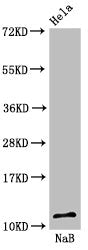 Western Blot  | Positive WB detected in: Hela cell acid extracts treated by 15mM NaB for 60min  | All lanes: HIST1H4A antibody at 1.6µg/ml  | Secondary  | Goat polyclonal to rabbit IgG at 1/50000 dilution  | Predicted band size: 12 kDa  | Observed band size: 12 kDaRabbit anti-Human HIST1H4A Polyclonal Antibody