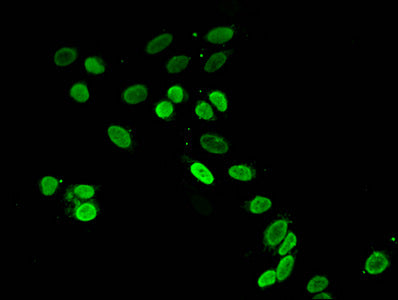 Immunofluorescent analysis of Hela cells using HIST1H4A (Ab-16) Antibody at dilution of 1:100 and Alexa Fluor 488-congugated AffiniPure Goat Anti-Rabbit IgG(H+L)Rabbit anti-Human HIST1H4A Polyclonal Antibody