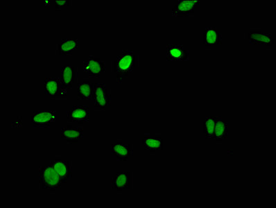 Immunofluorescence staining of Hela cells with HIST1H4A (Ab-1) Antibody at 1:25, counter-stained with DAPI. The cells were fixed in 4% formaldehyde, permeabilized using 0.2% Triton X-100 and blocked in 10% normal Goat Serum. The cells were then incubated with the antibody overnight at 4°C. The secondary antibody was Alexa Fluor 488-congugated AffiniPure Goat Anti-Rabbit IgG(H+L).Rabbit anti-Human HIST1H4A Polyclonal Antibody
