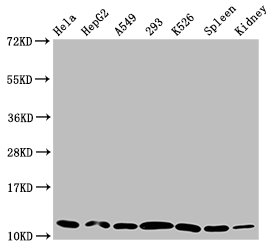 Western Blot  | Positive WB detected in: Hela whole cell lysate, HepG2 whole cell lysate, A549 whole cell lysate, 293 whole cell lysate, K562 whole cell lysate, Rat spleen tissue, Mouse kidney tissue  | All lanes: HIST1H4A antibody at 0.29μg/ml  | Secondary  | Goat polyclonal to rabbit IgG at 1/50000 dilution  | Predicted band size: 12 kDa  | Observed band size: 12 kDaRabbit anti-Human HIST1H4A Polyclonal Antibody