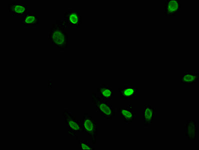 Immunofluorescence staining of Hela cells with Crotonyl-HIST1H4A (K5) Antibody at 1:75, counter-stained with DAPI. The cells were fixed in 4% formaldehyde, permeabilized using 0.2% Triton X-100 and blocked in 10% normal Goat Serum. The cells were then incubated with the antibody overnight at 4°C. The secondary antibody was Alexa Fluor 488-congugated AffiniPure Goat Anti-Rabbit IgG(H+L).Rabbit anti-Human HIST1H4A Polyclonal Antibody
