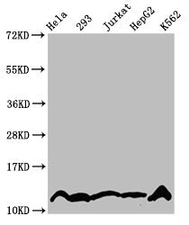 Western Blot  | Positive WB detected in: Hela whole cell lysate, 293 whole cell lysate, Jurkat whole cell lysate, HepG2 whole cell lysate, K562 whole cell lysate (treated by 30mM sodium crotonylate for 4h)  | All lanes: HIST1H4A antibody at 2.2μg/ml  | Secondary  | Goat polyclonal to rabbit IgG at 1/50000 dilution  | Predicted band size: 12 kDa  | Observed band size: 12 kDaRabbit anti-Human HIST1H4A Polyclonal Antibody