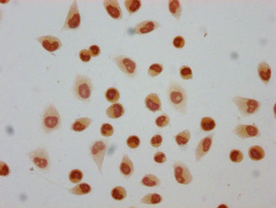 Immunocytochemistry analysis of 2-hydroxyisobutyryl-HIST1H4A (K5) Antibody diluted at 1:80 and staining in Hela cells (treated with 30mM sodium butyrate for 4h) performed on a Leica BondTM system. The cells were fixed in 4% formaldehyde, permeabilized using 0.2% Triton X-100 and blocked with 10% normal goat serum 30min at RT. Then primary antibody (1% BSA) was incubated at 4°C overnight. The primary is detected by a biotinylated secondary antibody and visualized using an HRP conjugated SP system.Rabbit anti-Human HIST1H4A Polyclonal Antibody