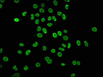 Immunofluorescence staining of Hela cells (treated with 30mM sodium butyrate for 4h) with 2-hydroxyisobutyryl-HIST1H4A (K5) Antibody at 1:40, counter-stained with DAPI. The cells were fixed in 4% formaldehyde, permeabilized using 0.2% Triton X-100 and blocked in 10% normal Goat Serum. The cells were then incubated with the antibody overnight at 4°C. The secondary antibody was Alexa Fluor 488-congugated AffiniPure Goat Anti-Rabbit IgG(H+L).Rabbit anti-Human HIST1H4A Polyclonal Antibody