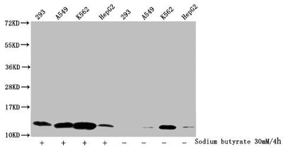 Western Blot  | Detected samples: 293 whole cell lysate, A549 whole cell lysate, K562 whole cell lysate, HepG2 whole cell lysate; Untreated (-) or treated (+) with 30mM sodium butyrate for 4h  | All lanes: HIST1H4A antibody at 1:2000  | Secondary  | Goat polyclonal to rabbit IgG at 1/40000 dilution  | Predicted band size: 12 kDa  | Observed band size: 12 kDaRabbit anti-Human HIST1H4A Polyclonal Antibody