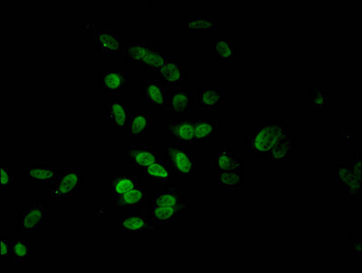 Immunofluorescent analysis of Hela cells using HIST1H4A (Ab-5) Antibody at dilution of 1:100 and Alexa Fluor 488-congugated AffiniPure Goat Anti-Rabbit IgG(H+L)Rabbit anti-Human HIST1H4A Polyclonal Antibody