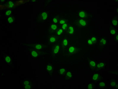 Immunofluorescence staining of Hela cells with HIST1H4A (Ab-5) Antibody at 1:1, counter-stained with DAPI. The cells were fixed in 4% formaldehyde, permeabilized using 0.2% Triton X-100 and blocked in 10% normal Goat Serum. The cells were then incubated with the antibody overnight at 4°C. The secondary antibody was Alexa Fluor 488-congugated AffiniPure Goat Anti-Rabbit IgG(H+L).Rabbit anti-Human HIST1H4A Polyclonal Antibody