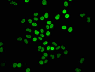 Immunofluorescence staining of Hela cells with HIST1H4A (Ab-5) Antibody at 1:1.3, counter-stained with DAPI. The cells were fixed in 4% formaldehyde, permeabilized using 0.2% Triton X-100 and blocked in 10% normal Goat Serum. The cells were then incubated with the antibody overnight at 4°C. The secondary antibody was Alexa Fluor 488-congugated AffiniPure Goat Anti-Rabbit IgG(H+L).Rabbit anti-Human HIST1H4A Polyclonal Antibody