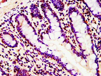 IHC image of HIST1H4A (Ab-5) Antibody diluted at 1:10 and staining in paraffin-embedded human small intestine tissue performed on a Leica BondTM system. After dewaxing and hydration, antigen retrieval was mediated by high pressure in a citrate buffer (pH 6.0). Section was blocked with 10% normal goat serum 30min at RT. Then primary antibody (1% BSA) was incubated at 4°C overnight. The primary is detected by a biotinylated secondary antibody and visualized using an HRP conjugated SP system.Rabbit anti-Human HIST1H4A Polyclonal Antibody