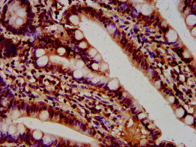 IHC image of HIST1H4A (Ab-5) Antibody diluted at 1:100 and staining in paraffin-embedded human small intestine tissue performed on a Leica BondTM system. After dewaxing and hydration, antigen retrieval was mediated by high pressure in a citrate buffer (pH 6.0). Section was blocked with 10% normal goat serum 30min at RT. Then primary antibody (1% BSA) was incubated at 4°C overnight. The primary is detected by a biotinylated secondary antibody and visualized using an HRP conjugated SP system.Rabbit anti-Human HIST1H4A Polyclonal Antibody