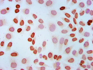 Immunocytochemistry analysis of Propionyl-HIST1H4A (K5) Antibody diluted at 1:100 and staining in Hela cells (treated with 10mM sodium propionate for 4h) performed on a Leica BondTM system. The cells were fixed in 4% formaldehyde, permeabilized using 0.2% Triton X-100 and blocked with 10% normal goat serum 30min at RT. Then primary antibody (1% BSA) was incubated at 4°C overnight. The primary is detected by a biotinylated secondary antibody and visualized using an HRP conjugated SP system.Rabbit anti-Human HIST1H4A Polyclonal Antibody