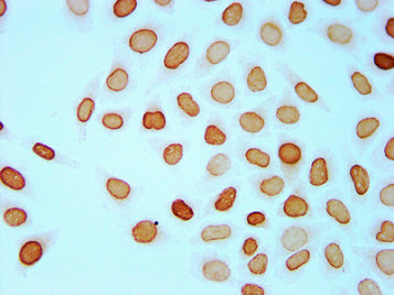 Immunocytochemistry analysis of Butyrly-HIST1H4A (K8) Antibody diluted at 1:75 and staining in Hela cells (treated with 30mM sodium butyrate for 4h) performed on a Leica BondTM system. The cells were fixed in 4% formaldehyde, permeabilized using 0.2% Triton X-100 and blocked with 10% normal goat serum 30min at RT. Then primary antibody (1% BSA) was incubated at 4°C overnight. The primary is detected by a biotinylated secondary antibody and visualized using an HRP conjugated SP system.Rabbit anti-Human HIST1H4A Polyclonal Antibody