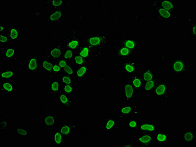 Immunofluorescence staining of Hela cells (treated with 30mM sodium butyrate for 4h) with Butyrly-HIST1H4A (K8) Antibody at 1:37.5, counter-stained with DAPI. The cells were fixed in 4% formaldehyde, permeabilized using 0.2% Triton X-100 and blocked in 10% normal Goat Serum. The cells were then incubated with the antibody overnight at 4°C. The secondary antibody was Alexa Fluor 488-congugated AffiniPure Goat Anti-Rabbit IgG(H+L).Rabbit anti-Human HIST1H4A Polyclonal Antibody