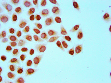 Immunocytochemistry analysis of Crotonyl-HIST1H4A (K8) Antibody diluted at 1:15 and staining in Hela cells (treated with 30mM sodium crotonylate for 4h) performed on a Leica BondTM system. The cells were fixed in 4% formaldehyde, permeabilized using 0.2% Triton X-100 and blocked with 10% normal goat serum 30min at RT. Then primary antibody (1% BSA) was incubated at 4°C overnight. The primary is detected by a biotinylated secondary antibody and visualized using an HRP conjugated SP system.Rabbit anti-Human HIST1H4A Polyclonal Antibody