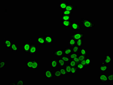 Immunofluorescence staining of Hela cells (treated with 30mM sodium crotonylate for 4h) with Crotonyl-HIST1H4A (K8) Antibody at 1:7.5, counter-stained with DAPI. The cells were fixed in 4% formaldehyde, permeabilized using 0.2% Triton X-100 and blocked in 10% normal Goat Serum. The cells were then incubated with the antibody overnight at 4°C. The secondary antibody was Alexa Fluor 488-congugated AffiniPure Goat Anti-Rabbit IgG(H+L).Rabbit anti-Human HIST1H4A Polyclonal Antibody