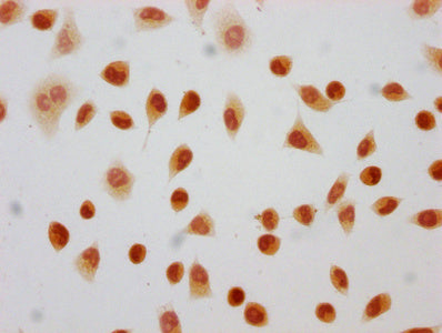 Immunocytochemistry analysis of 2-hydroxyisobutyryl-HIST1H4A (K8) Antibody diluted at 1:15 and staining in Hela cells (treated with 30mM sodium butyrate for 4h) performed on a Leica BondTM system. The cells were fixed in 4% formaldehyde, permeabilized using 0.2% Triton X-100 and blocked with 10% normal goat serum 30min at RT. Then primary antibody (1% BSA) was incubated at 4°C overnight. The primary is detected by a biotinylated secondary antibody and visualized using an HRP conjugated SP system.Rabbit anti-Human HIST1H4A Polyclonal Antibody
