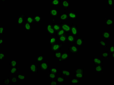 Immunofluorescence staining of Hela cells (treated with 30mM sodium butyrate for 4h) with 2-hydroxyisobutyryl-HIST1H4A (K8) Antibody at 1:7.5, counter-stained with DAPI. The cells were fixed in 4% formaldehyde, permeabilized using 0.2% Triton X-100 and blocked in 10% normal Goat Serum. The cells were then incubated with the antibody overnight at 4°C. The secondary antibody was Alexa Fluor 488-congugated AffiniPure Goat Anti-Rabbit IgG(H+L).Rabbit anti-Human HIST1H4A Polyclonal Antibody