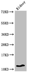 Western Blot  | Positive WB detected in: Mouse kidney tissue  | All lanes: HIST1H4A antibody at 2µg/ml  | Secondary  | Goat polyclonal to rabbit IgG at 1/50000 dilution  | Predicted band size: 12 kDa  | Observed band size: 12 kDaRabbit anti-Human HIST1H4A Polyclonal Antibody