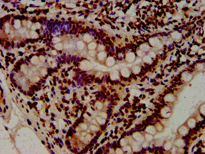 IHC image of HIST1H4A (Ab-8) Antibody diluted at 1:10 and staining in paraffin-embedded human small intestine tissue performed on a Leica BondTM system. After dewaxing and hydration, antigen retrieval was mediated by high pressure in a citrate buffer (pH 6.0). Section was blocked with 10% normal goat serum 30min at RT. Then primary antibody (1% BSA) was incubated at 4°C overnight. The primary is detected by a biotinylated secondary antibody and visualized using an HRP conjugated SP system.Rabbit anti-Human HIST1H4A Polyclonal Antibody