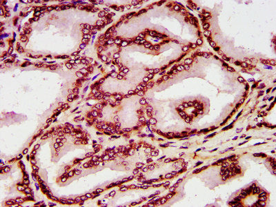IHC image of HIST1H4A (Ab-8) Antibody diluted at 1:10 and staining in paraffin-embedded human prostate tissue performed on a Leica BondTM system. After dewaxing and hydration, antigen retrieval was mediated by high pressure in a citrate buffer (pH 6.0). Section was blocked with 10% normal goat serum 30min at RT. Then primary antibody (1% BSA) was incubated at 4°C overnight. The primary is detected by a biotinylated secondary antibody and visualized using an HRP conjugated SP system.Rabbit anti-Human HIST1H4A Polyclonal Antibody