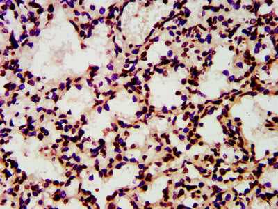 IHC image of HIST1H4A (Ab-8) Antibody diluted at 1:10 and staining in paraffin-embedded human lung tissue performed on a Leica BondTM system. After dewaxing and hydration, antigen retrieval was mediated by high pressure in a citrate buffer (pH 6.0). Section was blocked with 10% normal goat serum 30min at RT. Then primary antibody (1% BSA) was incubated at 4°C overnight. The primary is detected by a biotinylated secondary antibody and visualized using an HRP conjugated SP system.Rabbit anti-Human HIST1H4A Polyclonal Antibody