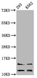 Western Blot  | Positive WB detected in: 293 whole cell lysate, K562 whole cell lysate  | All lanes: HIST1H4A antibody at 0.86µg/ml  | Secondary  | Goat polyclonal to rabbit IgG at 1/50000 dilution  | Predicted band size: 12 kDa  | Observed band size: 12, 14 kDaRabbit anti-Human HIST1H4A Polyclonal Antibody