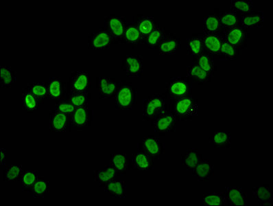 Immunofluorescence staining of Hela cells with HIST1H4A (Ab-8) Antibody at 1:1.25, counter-stained with DAPI. The cells were fixed in 4% formaldehyde, permeabilized using 0.2% Triton X-100 and blocked in 10% normal Goat Serum. The cells were then incubated with the antibody overnight at 4°C. The secondary antibody was Alexa Fluor 488-congugated AffiniPure Goat Anti-Rabbit IgG(H+L).Rabbit anti-Human HIST1H4A Polyclonal Antibody
