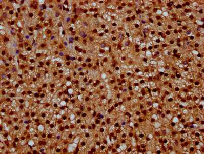 IHC image of the antibody diluted at 1:10 and staining in paraffin-embedded human adrenal gland tissue performed on a Leica BondTM system. After dewaxing and hydration, antigen retrieval was mediated by high pressure in a citrate buffer (pH 6.0). Section was blocked with 10% normal goat serum 30min at RT. Then primary antibody (1% BSA) was incubated at 4°C overnight. The primary is detected by a biotinylated secondary antibody and visualized using an HRP conjugated SP system.Rabbit anti-Human HIST1H4A Polyclonal Antibody