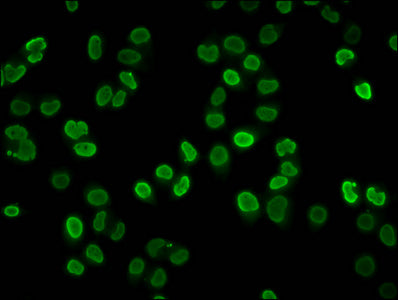 Immunofluorescence staining of Hela cells (treated with 10mM sodium propionate for 4h) with Propionyl-HIST1H4A (K8) Antibody at 1:25, counter-stained with DAPI. The cells were fixed in 4% formaldehyde, permeabilized using 0.2% Triton X-100 and blocked in 10% normal Goat Serum. The cells were then incubated with the antibody overnight at 4°C. The secondary antibody was Alexa Fluor 488-congugated AffiniPure Goat Anti-Rabbit IgG(H+L).Rabbit anti-Human HIST1H4A Polyclonal Antibody